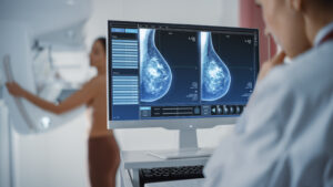 A radiologist looking at images from a woman’s first mammogram