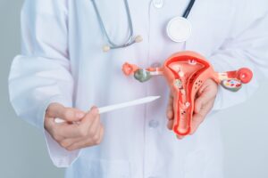 Doctor holds an anatomical model of a uterus to explain uterine fibroids to a patient